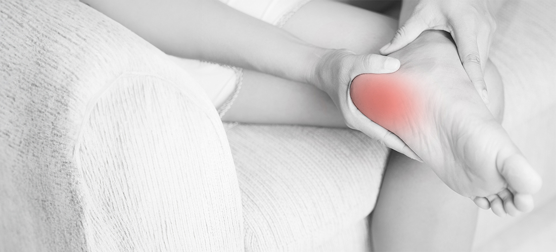 Rivea Vascular image of foot with plantar fasciitis symptoms