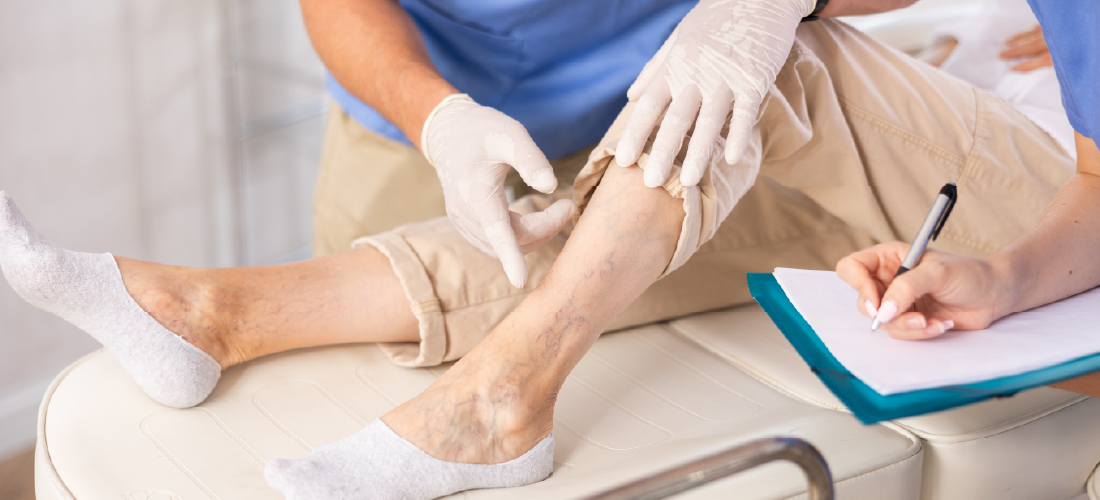 Best Vascular Hospital In Hyderabad