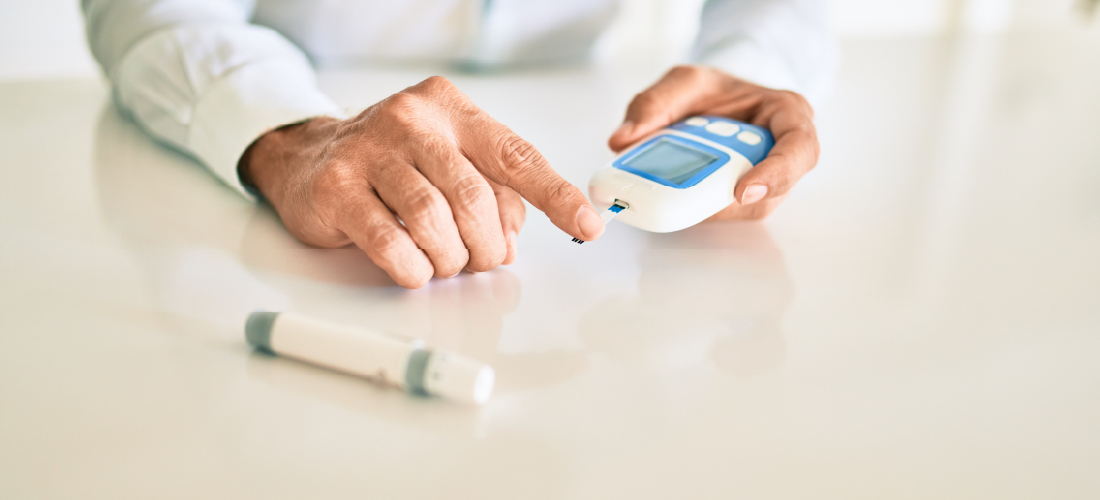 Varicose veins treatment and symptoms – RIVEA Vascular blog image