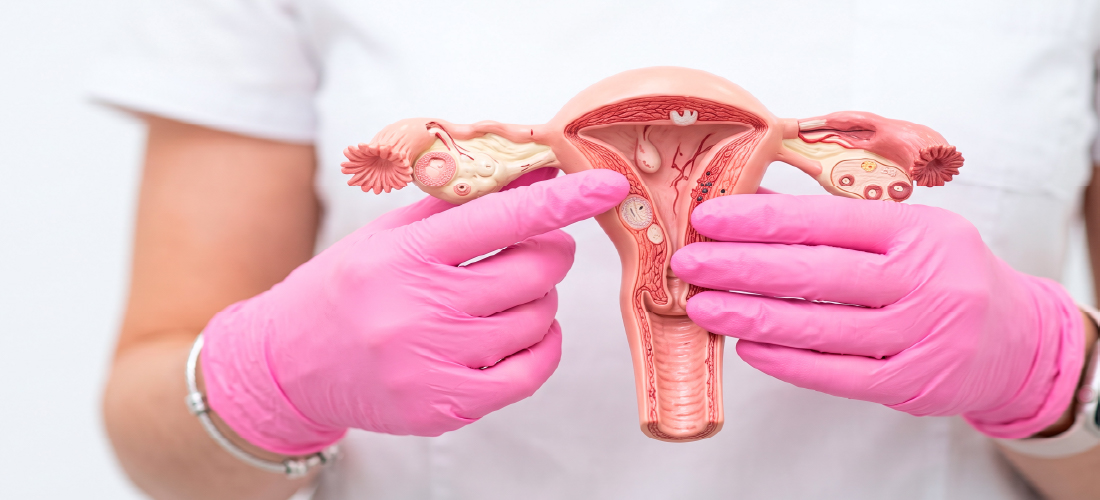 Minimally invasive uterine fibroid embolization compared with surgical treatments