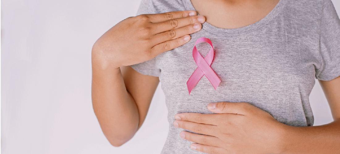 Lymphedema after breast cancer treatment showing lymphatic swelling and vascular care awareness