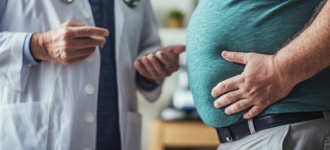 Obesity affecting circulation and vein health
