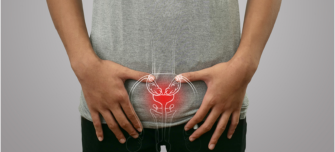 Prostatic Artery Embolization procedure and post-treatment care