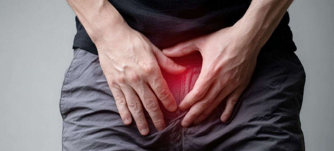 Varicocele and its impact on male fertility treatment in Hyderabad