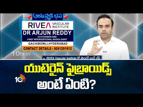Uterine Fibroid Embolization procedure at RIVEA – advanced non-surgical treatment for fibroids