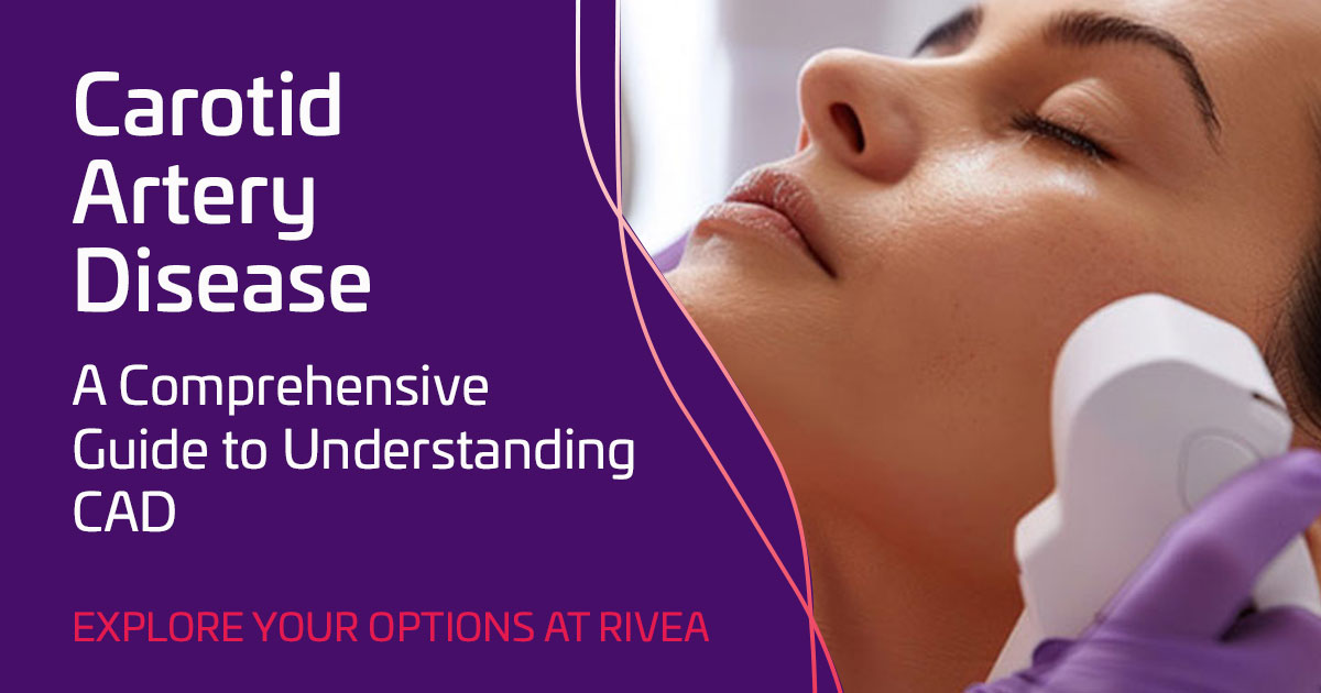 Carotid Artery Disease treatment in Hyderabad | RIVEA