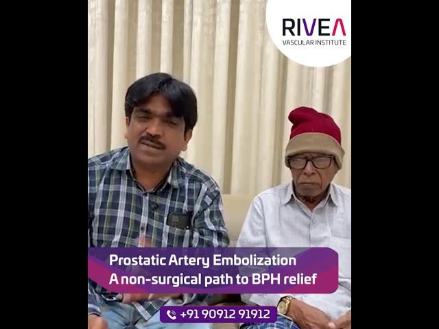 PAE Helped Treat a 127cc Enlarged Prostate