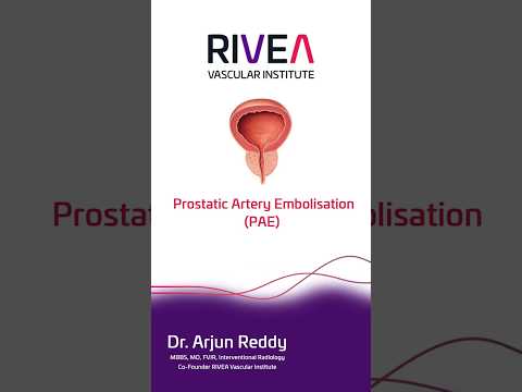 Patient-focused care for living with an enlarged prostate – RIVEA Vascular