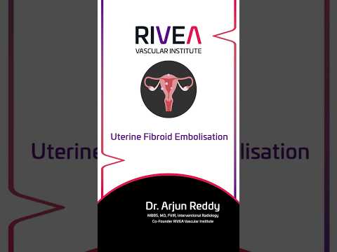 Patient-focused care for living with an enlarged prostate – RIVEA Vascular